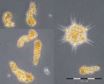 Bild 2: Verrucophora farcimen und Dictyocha speculum vom 10.3.2015