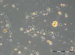 Bild 5: Dactyliosolen fragilissimus in der Probe vom 3.7.2018.