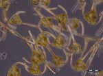 Image 8: Ceratium tripos, net sample from 22.10.2013
