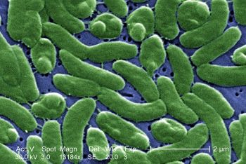 Rasterelektronenmikroskop-Aufnahme von Bakterien der Art Vibrio vulnificus