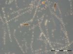Image 1: Microscopic overview from 8.3.2016 with Skeletonema marinoi and Eutreptiella braarudii