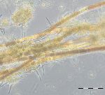 Bild 8: Nodularia spumigena, zum Teil gealtert und von Nitzschia paleacea bewachsen  (23.8.2016)