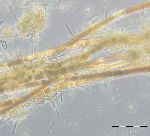 Bild 8: Nodularia spumigena, zum Teil gealtert und von Nitzschia paleacea bewachsen (23.8.2016)