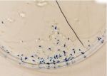 Abbildung 3: Über 18S rRNA basierte Gensonden gefärbtes Zooplankton (Foto: Thorben Hofmann)