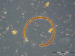 Bild 6: Nodularia spumigena mit Beimischung diverser Cryptophyceen und Prymnesiophyceen vom 1.8.2017.