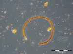 Bild 6:  Nodularia spumigena mit Beimischung diverser Cryptophyceen und Prymnesiophyceen vom 1.8.2017.