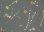 Bild 2: Skeletonema marinoi, Dictyocha speculum (nackte Form) und Teleaulax sp. vom 28.2.2017.