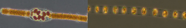 Cyanobakterie (links) und Skeltonema (rechts) unter dem Mikroskop mit 400-facher Vergroesserung