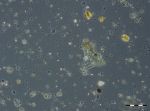 Image 3: High concentration of particles, that impede the counting. Sample from 18.3.2014