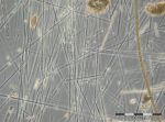 Bild 6: Blüte von Proboscia alata mit Beimischung von Nodularia spumigena, Dolichospermum sp. und Dactyliosolen fragilissimus (Netzprobe vom 26.7.2016)