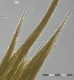 Image 10: Aphanizomenon sp., net sample from 12.8.2014