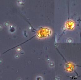 Bild 6: Chrysochromulina spp.
