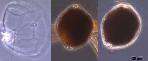 Bild 7: Alexandrium pseudogonyaulax