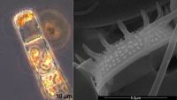 Bild 3: Detonula confervacea (Licht- und elektronenmikroskopisches Bild)