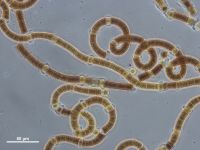 Bild 5: Nodularia spumigena, Netzprobe vom 9.7.2013