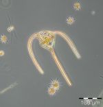 Bild 5: Dictyocha speculum mit Kieselskelett, Ceratium tripos und Chaetoceros similis; Probe vom 29.4.2014