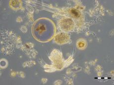 Planktonorganismen unter dem Mikroskop