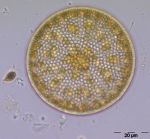 Bild 4: Coscinodiscus radiatus