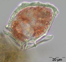Dinoflagellat Dinophysis norvegica