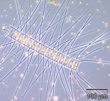 Kieselalgen Chaetoceros decipiens