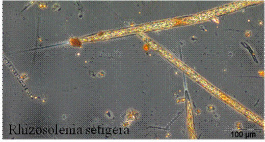 Rhizosolenia setigera