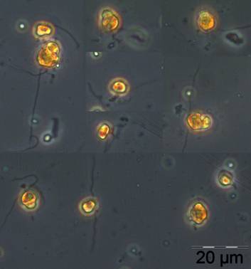 Chrysochromulina sp.