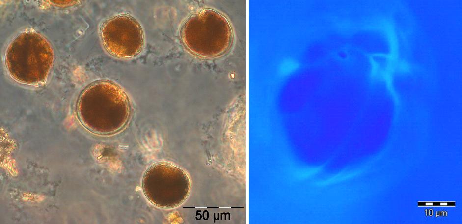 Alexandrium pseudogonyaulax im Hellfeld und unter Calcofluor-Fluoreszenz