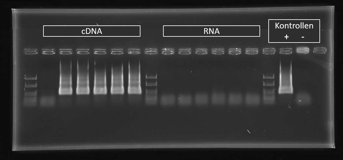 Bild 2: Gelbild cDNA und RNA