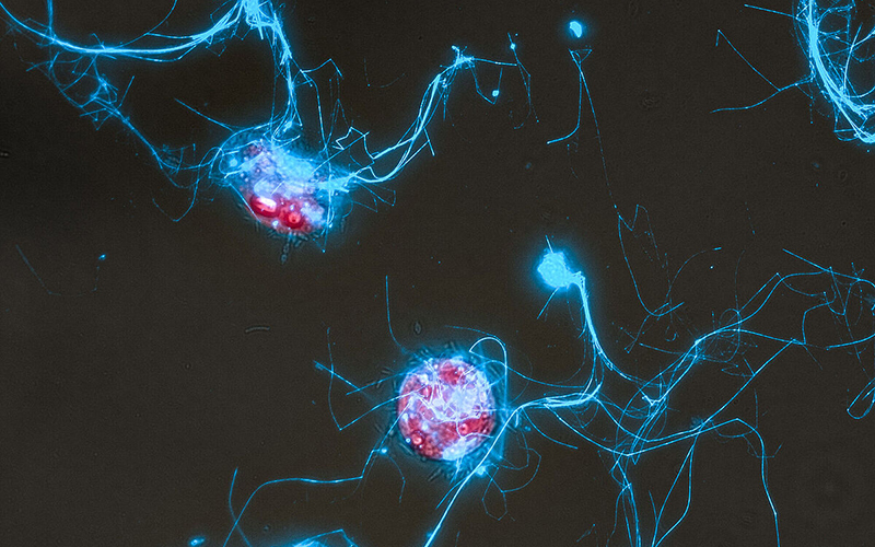 Die Kieselalge Conticribra weissflogii (rot) und die von ihr ausgeschiedenen Zuckerpolymerstrukturen (blau).