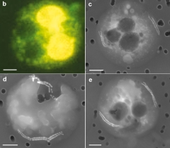 Image of magnetotactic bacteria